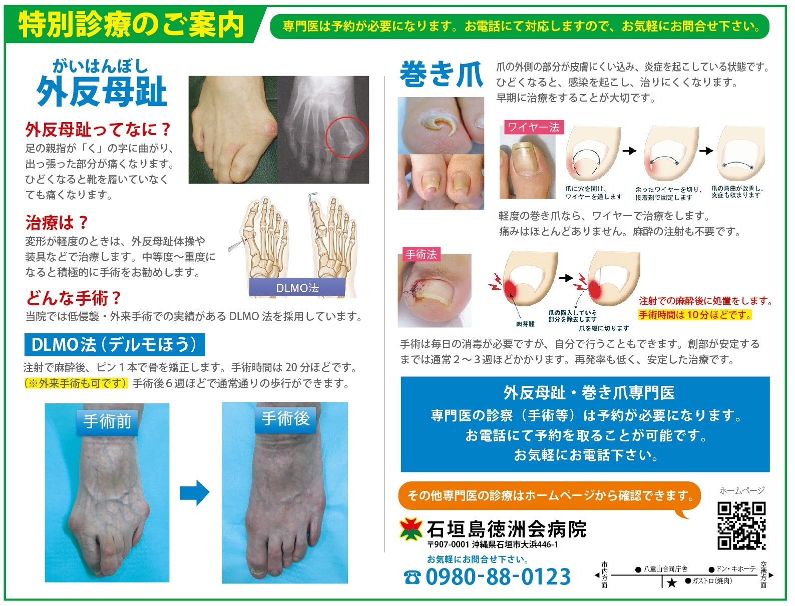 整形外科 外反母趾・巻き爪の案内